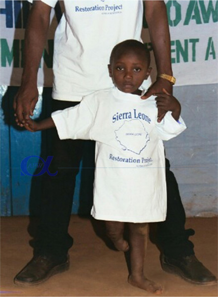 Aberdeen Amputee Camp picture3